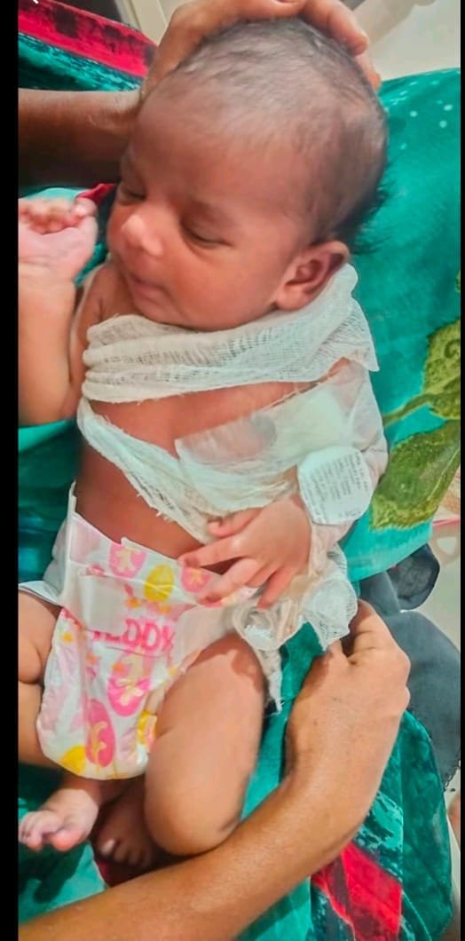 अकोला: नवजात बाळाचा हात मोडल्याची घटना ; चौकशी समिती गठीत..