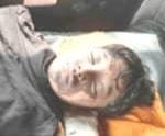 महावितरण चा निष्काळजी पणा नांदुरा येथे मुलगा भाजून पोहचला मृत्यूच्या दारात....